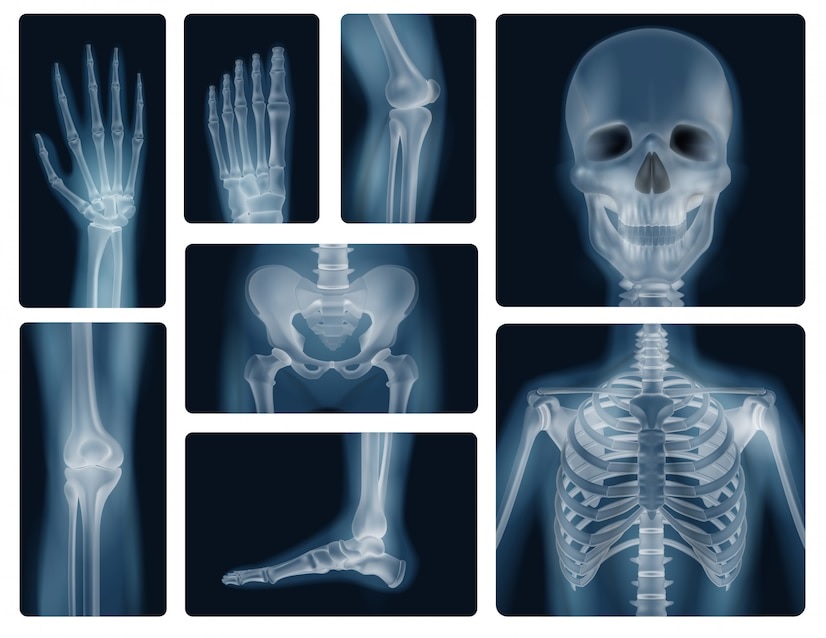 CV röntgentekniker